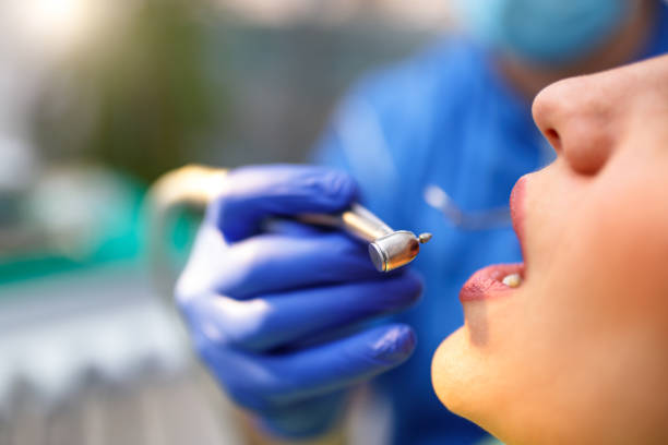 Best Wisdom Tooth Removal  in Aristocrat Ranchettes, CO